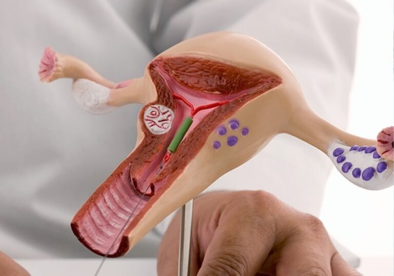 All About Intrauterine Insemination (IUI): What You Need To Know?