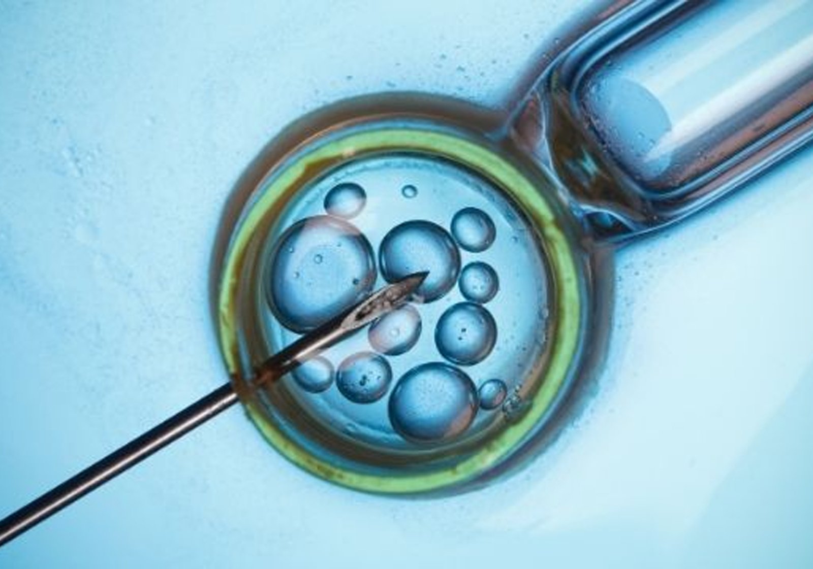 IVF treatment