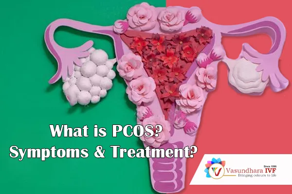 PCOS