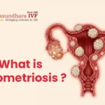 Endometriosis: Symptoms, Causes, Diagnosis & Treatment Options for Better Fertility