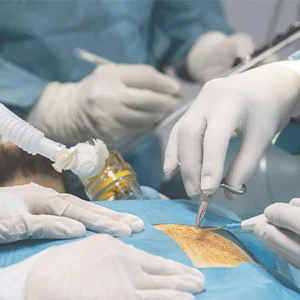 Fertility Enhancing Surgeries