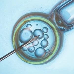 IVF Treatment